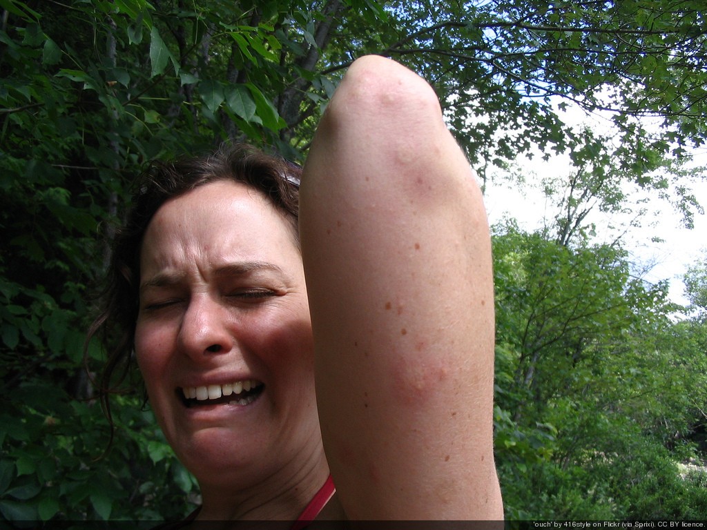 #007 Γιατί δεν με καταδιώκεις ΚΩΝΩΠΑ;